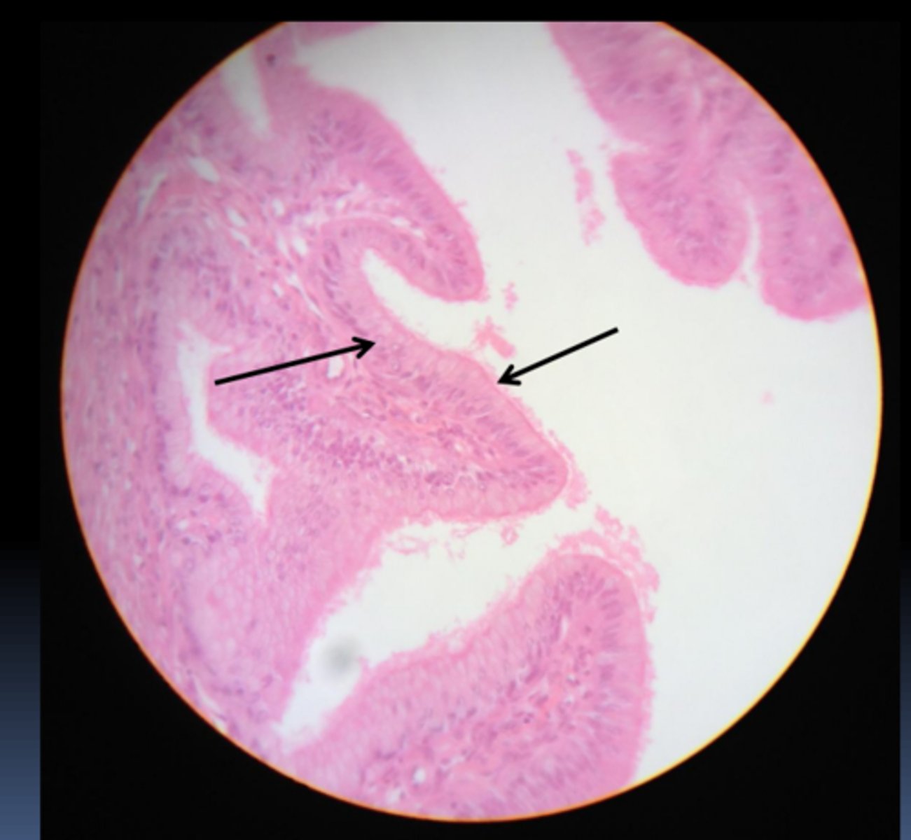 <p>What is this particular subtype?</p>