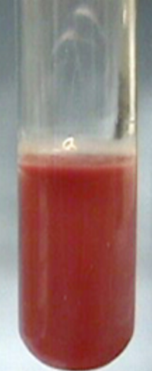 <p>Is this a positive or negative motility agar test?</p>