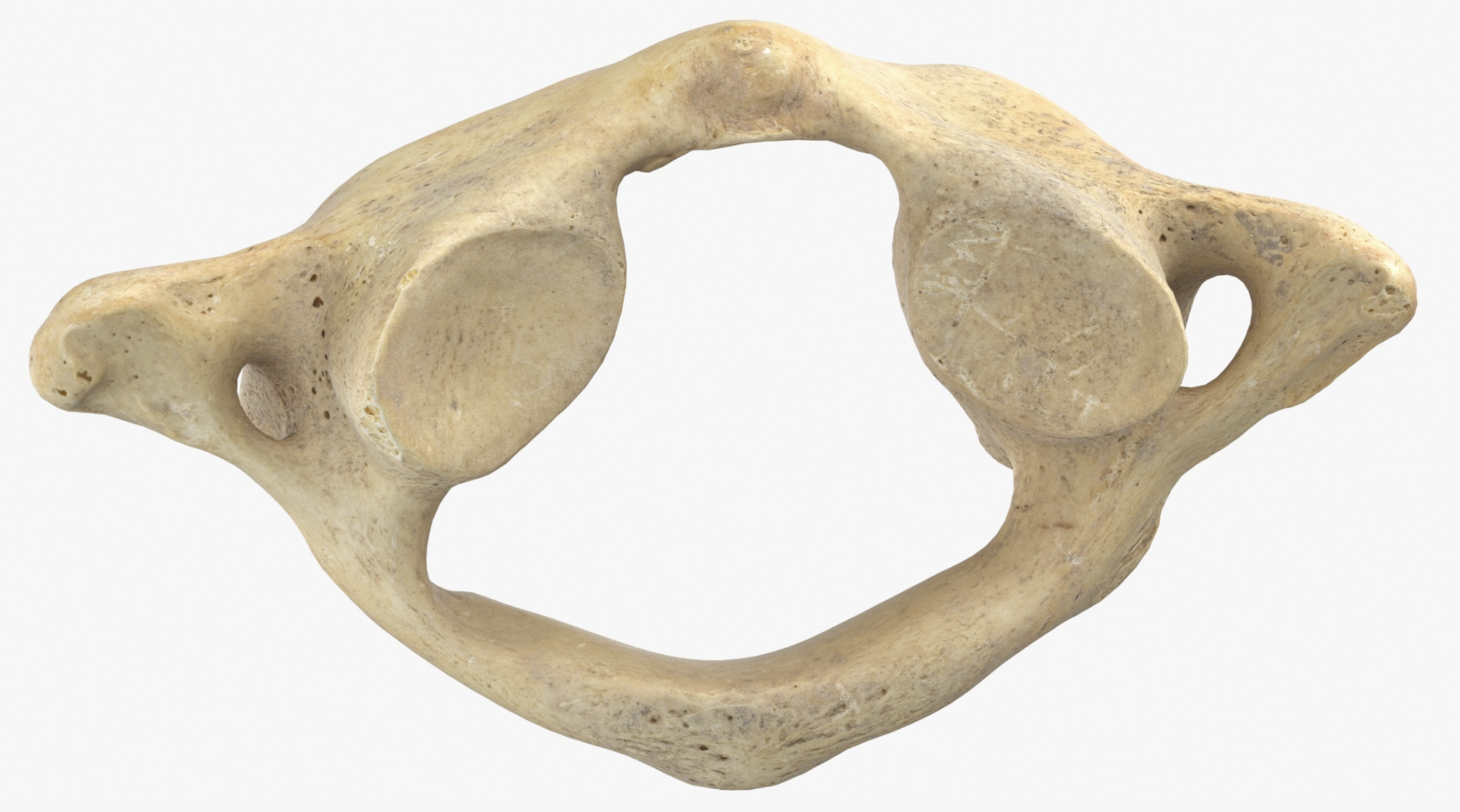 <p>What vertebra is this?</p>