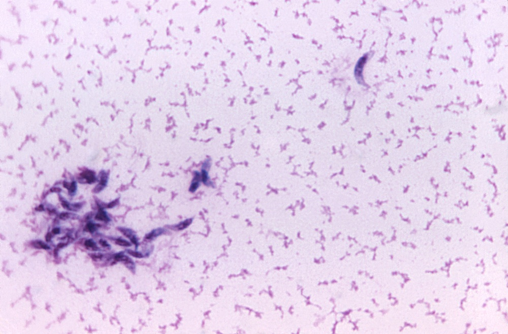 <p>in abdominal fluid from cats</p><p>cerebral calcification, muscle aches in humans</p><p>worldwide</p>
