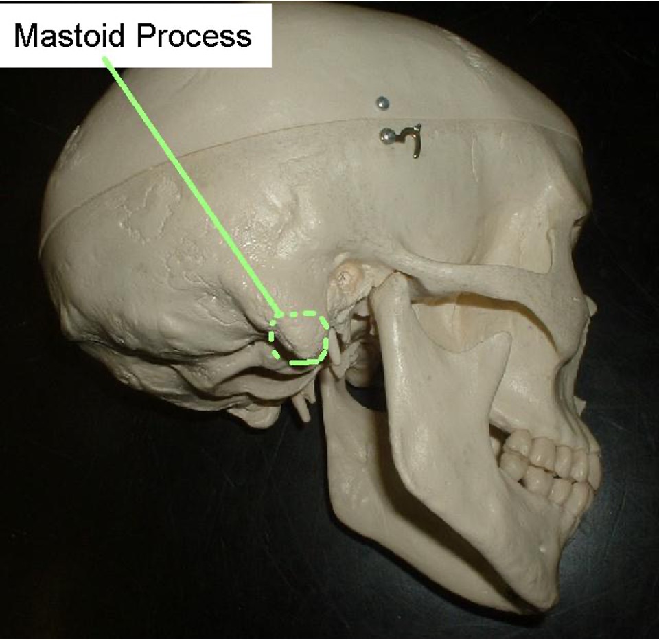 <p>below the mastoid portion that is small, circular, and pinchable.</p>