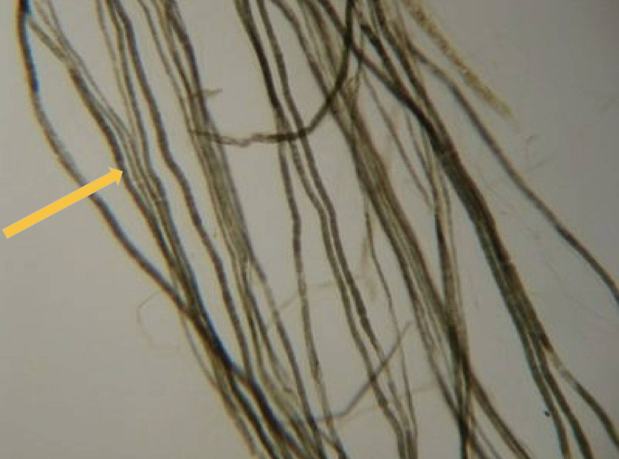 <p>labeled</p>