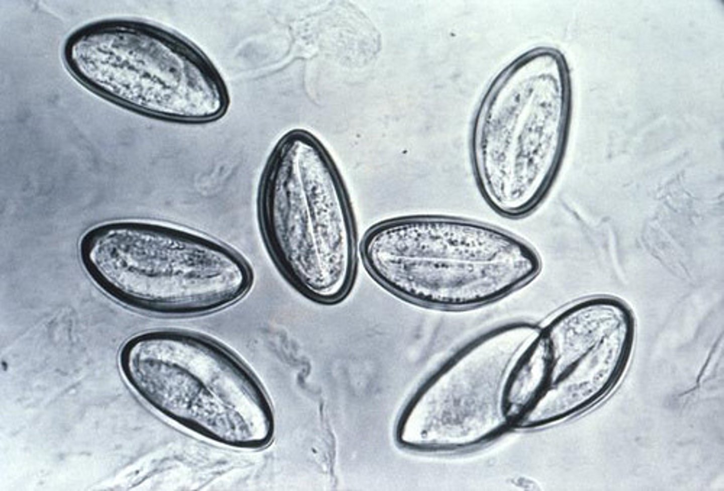 <p>Oxyuris equi</p>