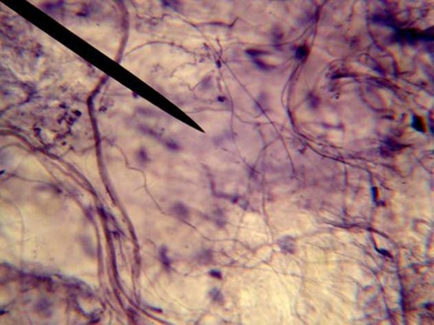 <p>loose connective tissue. Location: beneath skin, between muscle tissues, beneath epithelial tissue. Function: binds organs and tissue together.</p>