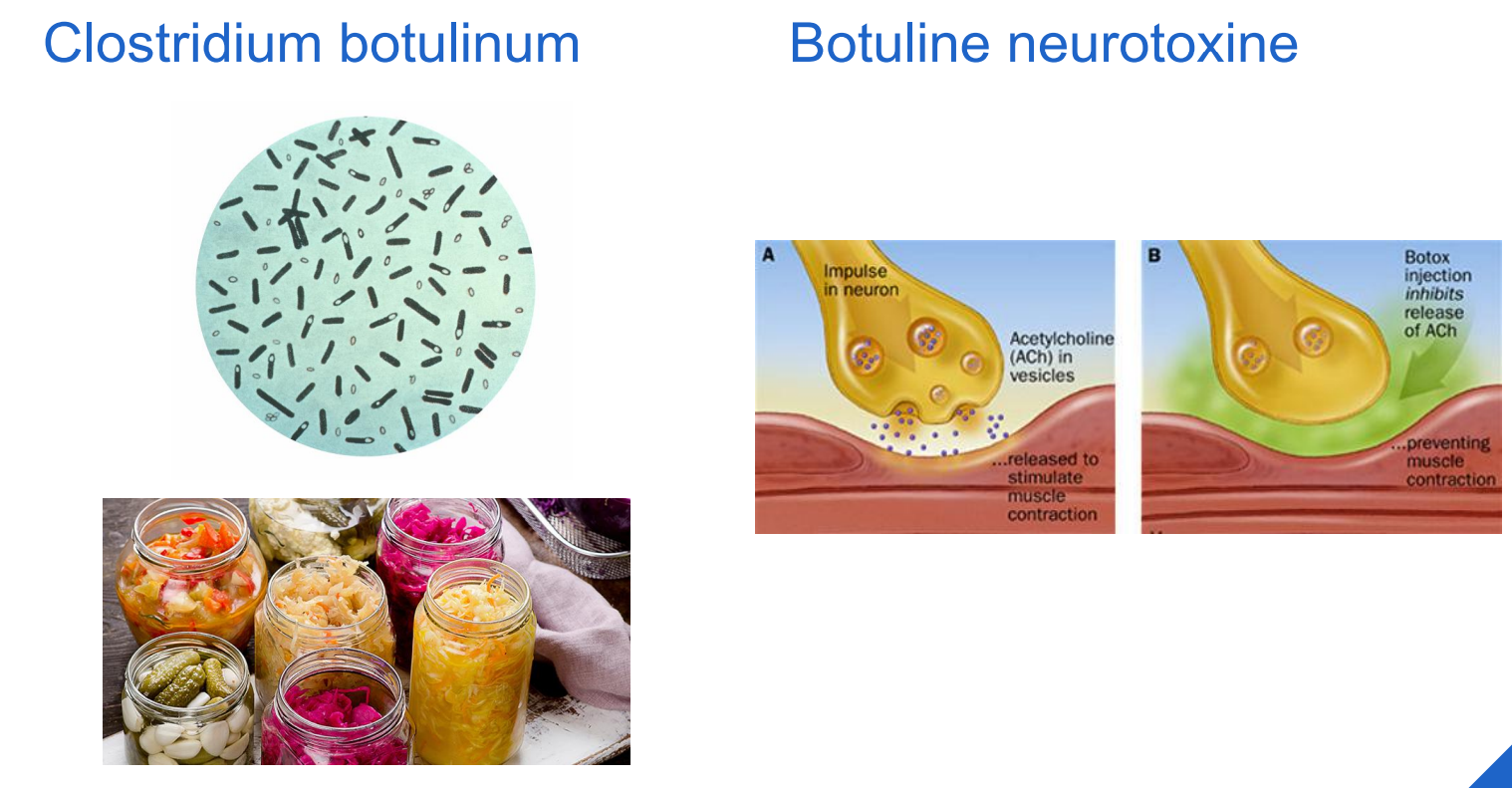 <ul><li><p>Anticholinergisch (vermindering productie)</p><ul><li><p>Scopolamine (niet beschikbaar)</p></li><li><p>Glycopyrroniumsiroop :&nbsp;Glycopyrroniumbromide 0,2mg/mL </p></li><li><p>bijwerkingen: rusteloosheid, obstipatie, droge mond, urineretentie, zichtstoornissen, gedragsverandering </p></li><li><p>Interacties </p></li><li><p>Dosistitratie (16mcg/kg 3x/d, wekelijks verhogen) </p></li><li><p>Nadeel: DUUR</p></li></ul></li><li><p>Botulinetoxine (Botox<span data-name="registered" data-type="emoji">®</span>, Xeomeen<span data-name="registered" data-type="emoji">®</span>, e.a.)</p><ul><li><p>Infiltratie in de parotis en submandibulaire speekselklieren </p></li><li><p>Blokkeert acetylcholine thv parasympatische zenuwuiteinden </p></li><li><p>Effect na enkele d, max effect na 2 a 4w </p></li><li><p>4-6 tal maanden effect</p></li></ul></li></ul><p></p>