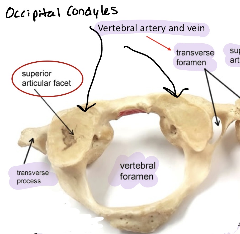 <p>No vertebral body and no spinous process</p>