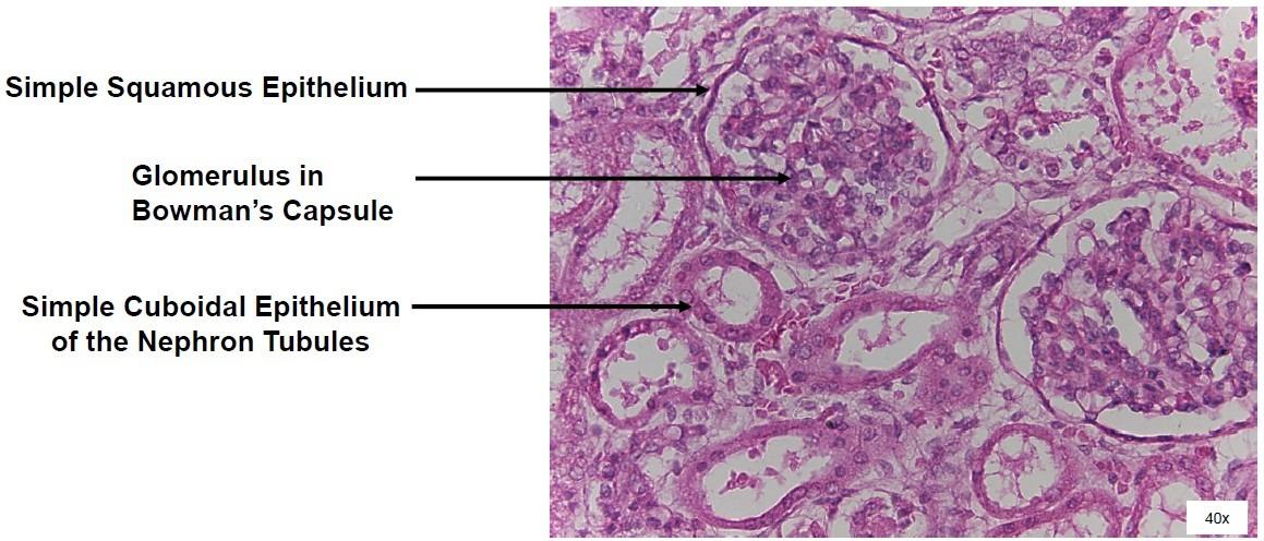 <p>1- simple squamous epithelium </p><p>2- glomerulus (bowman’s capsule)</p><p>3- simple cuboidal epithelium </p>