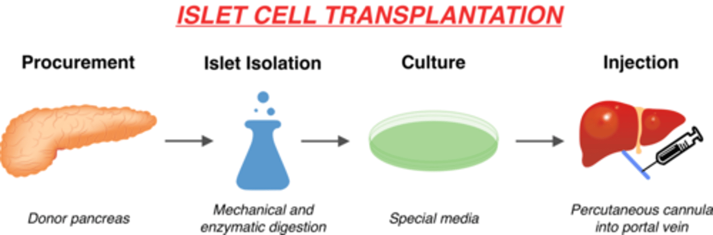 <p>- beta cell transplant + immunosuppressant drugs (eg. Tacrolimus)</p><p>- 2-3 infusions of islet cells required (over time)</p><p>- challenges: donor numbers; chronic immunosuppression</p>