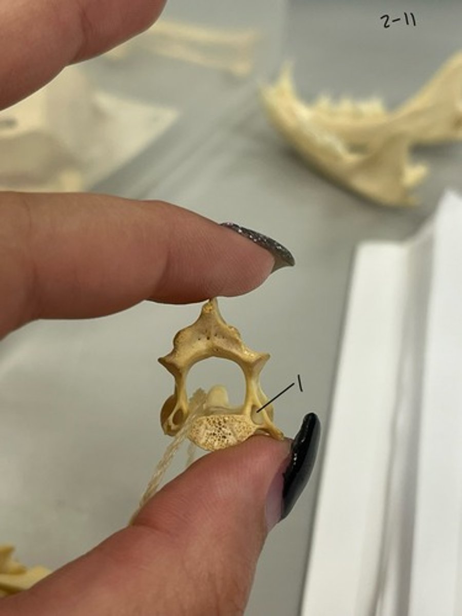 <p>Entire Structure?</p>