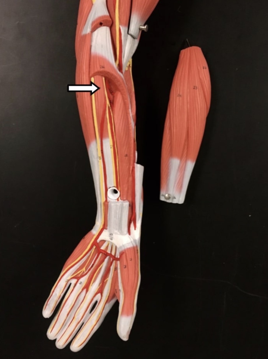 <p><span>Name the muscle labeled with the white arrow below AND name the origin .</span></p>