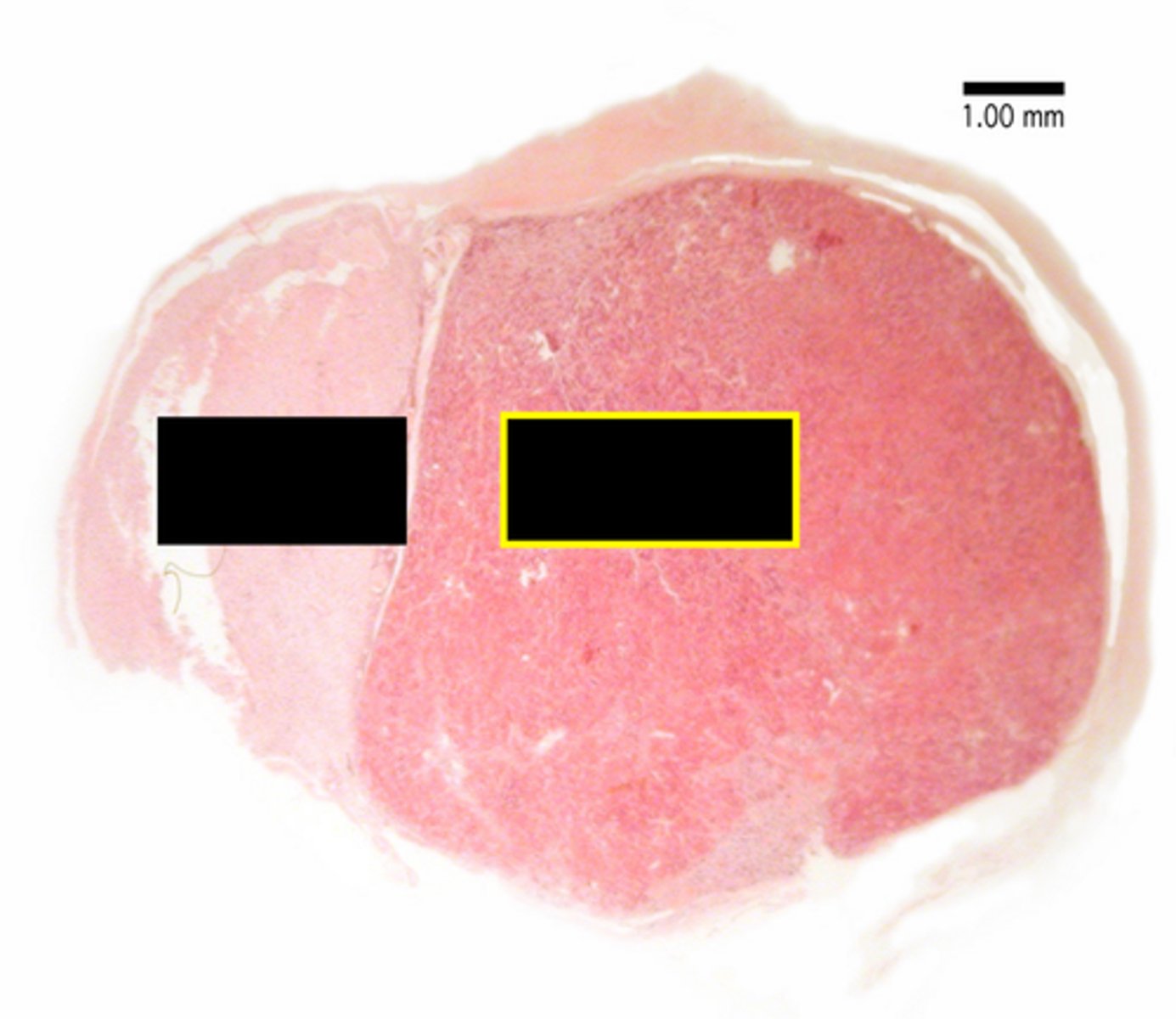 <p>Glandular tissue that manufactures and secretes GH, TSH, ACTH, FSH, LH, and PRL.</p>