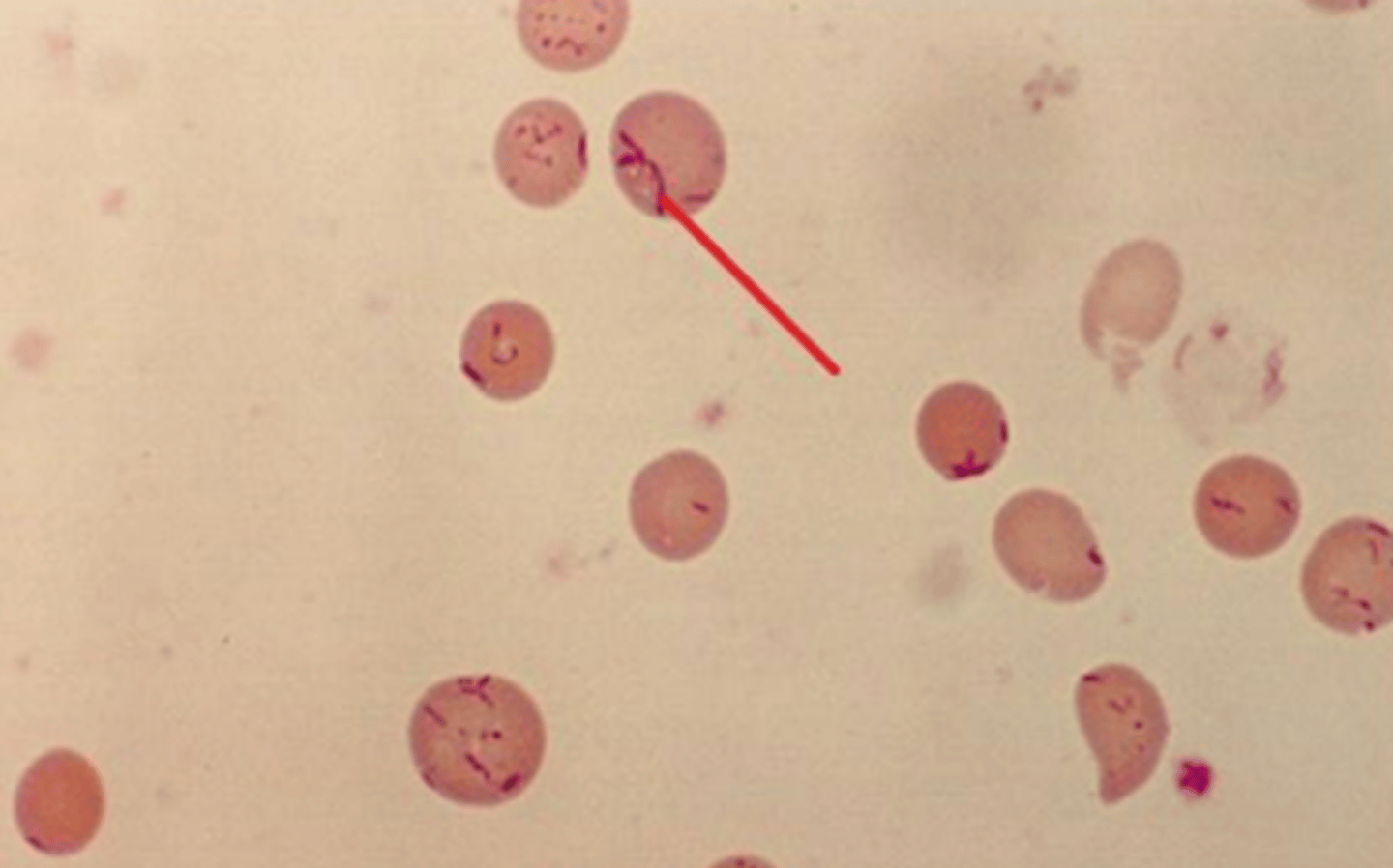<p>Gram-negative bacillus intracellular</p><p>Causes cat scratch disease and fever/lymphadenopathy</p><p>Flea borne</p><p>Zoonotic</p>