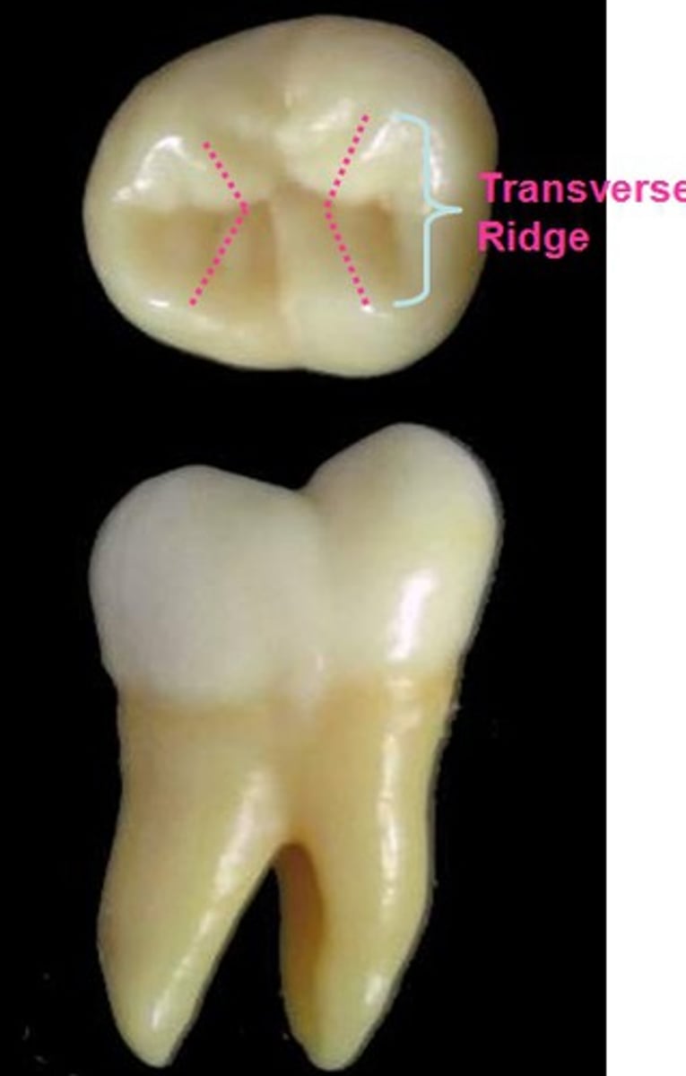 <p>- on posterior teeth</p><p>TR</p><p>- all posterior cusps have these (exc. mesiolingual cusp on maxillary molars)</p><p>TR</p><p>- on occlusal surfaces on lower premolars</p><p>- represents union btwn triangular ridges of 2 opposing cusps</p><p>OR</p><p>- on occlusal surfaces of upper molars</p><p>- union between 2 non-opposing cusps</p><p>- MESIOLINGUAL OR DISTOBUCCAL ONLY!</p>