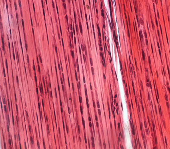 <p>Щільна сполучна тканина</p>