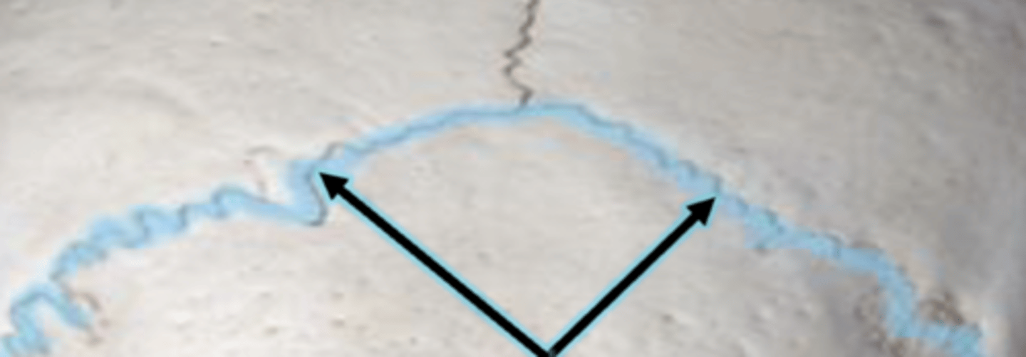 <p>lambdoid suture</p>