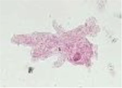 <p>What is this (classification of protozoa based on locomotion structure)</p>