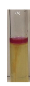 <p>Sulfur Reduction Indol Production Motility</p>