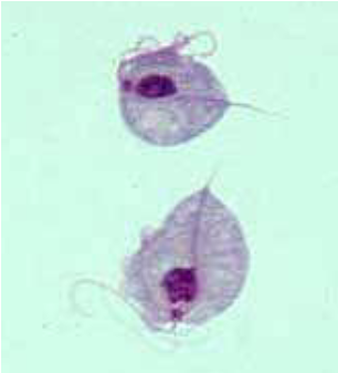 <ul><li><p><span>Urogenital pathogen in men and women</span></p></li><li><p><span><u>Only seen in troph stage</u></span></p></li><li><p><span>Found in various body sites</span></p><ul><li><p><span>Urine, vaginal secretions, prostatic secretions</span></p></li></ul></li><li><p><span>Transmitted through sexual contact</span></p></li><li><p><span>Women – itching, burning, dysuria, foamy, yellow-green discharge, foul odor</span></p></li><li><p><span>Men – usually asymptomatic</span></p><ul><li><p><span>May see prostatitis, urethritis, epididymitis, urethral stricture</span></p></li></ul></li></ul><p></p>