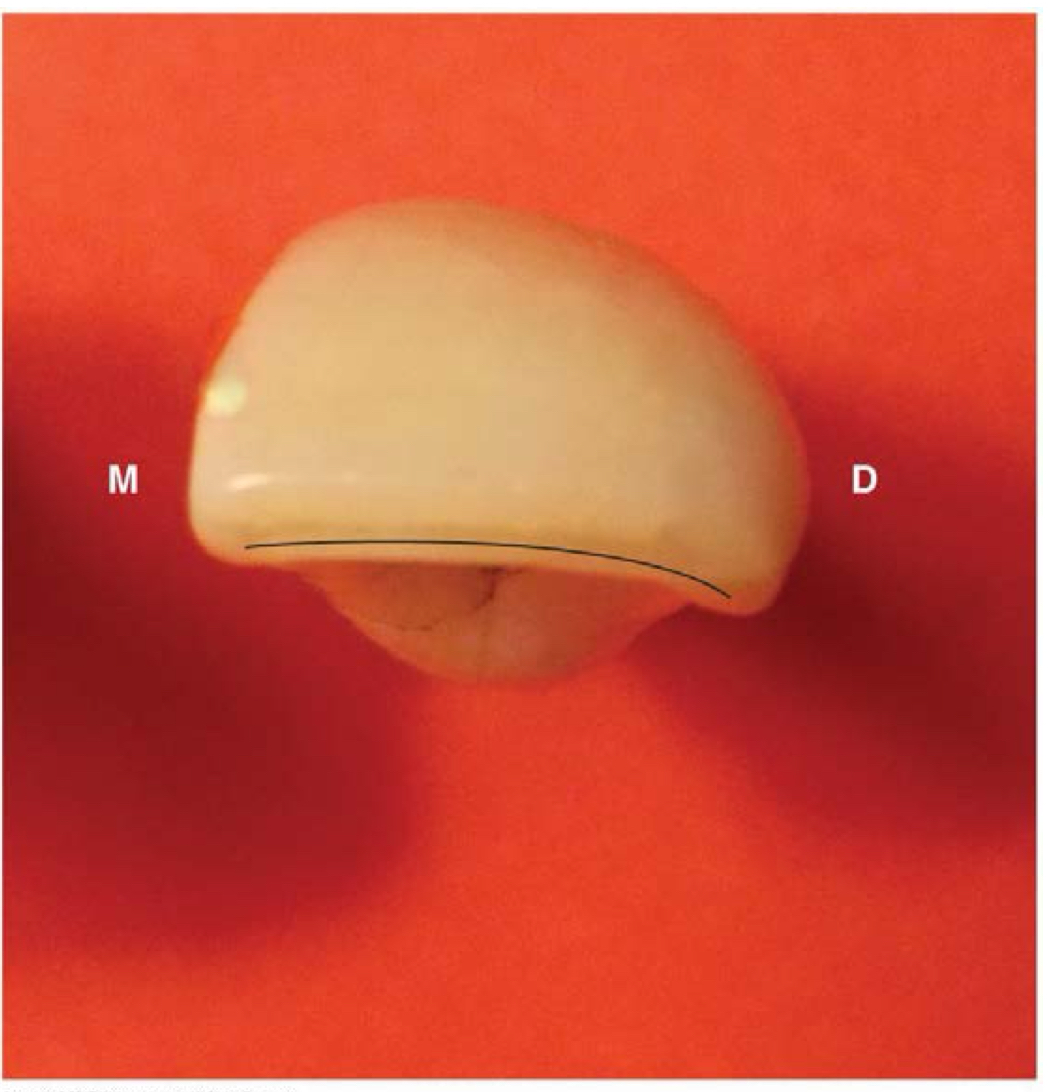 <p>A distolingual twist</p>