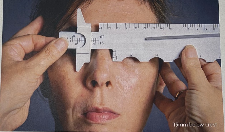 <p>Move the ruler horizontally so that the lower edge of the right side of the ruler rests against the left side of the nose. With the cursor in position move it until the lower point on the cursor just touches the left side of the nose, so that the nose is gently calipered between these two points.</p><p>The measurement can be taken on the 15mm scale.</p>