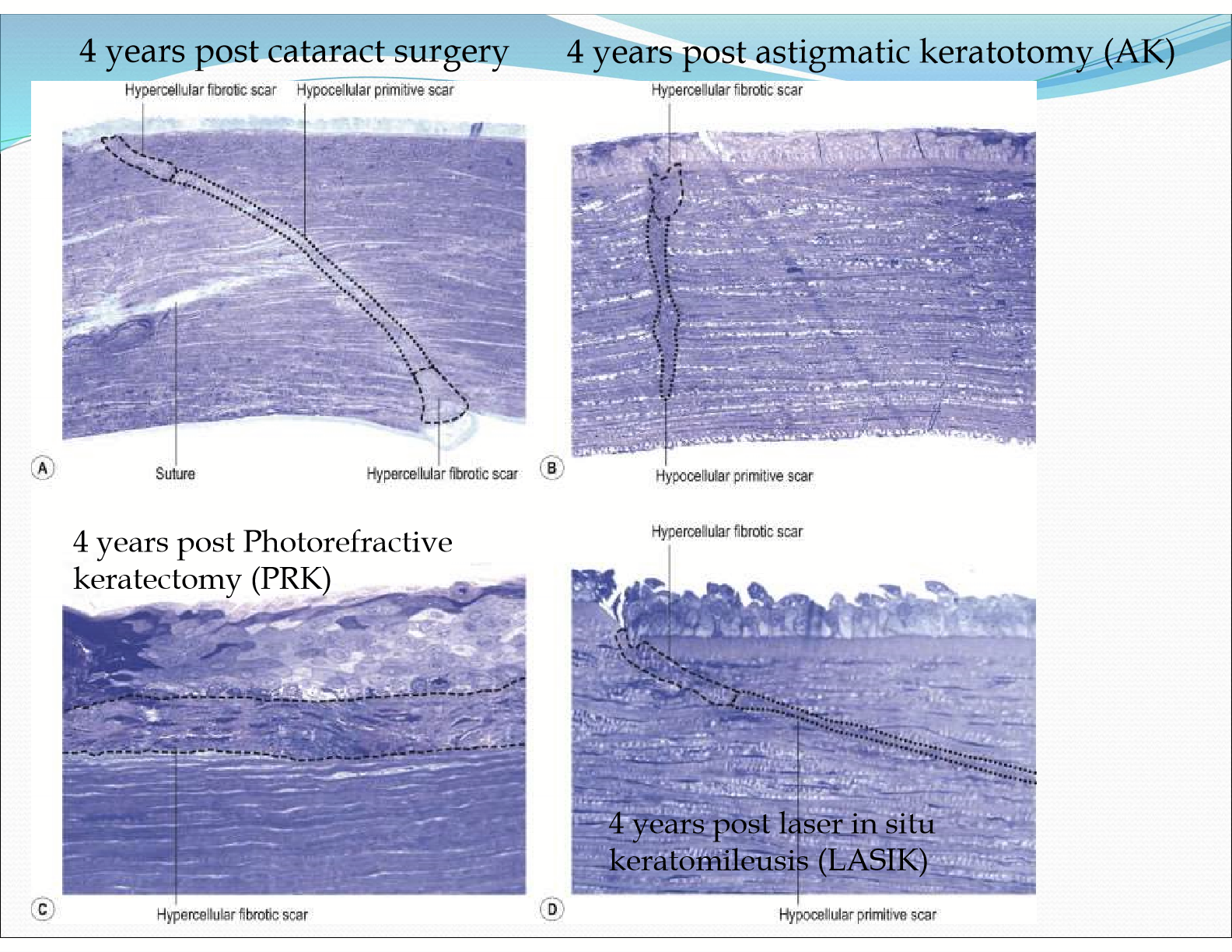 <p>No, there are scar tissues from healing, clearly seen from surgeries</p>