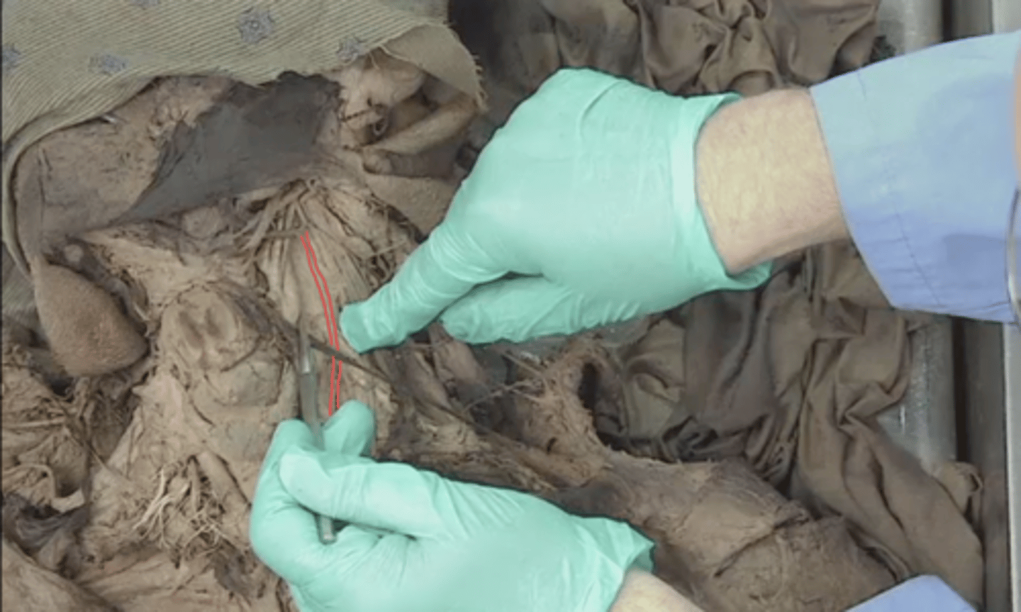 <p>identify this structure (behind internal jugular vein and vagus nerve)</p>