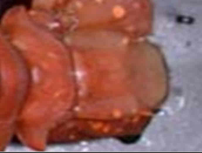 <p>Identify the central flap on this structure</p>