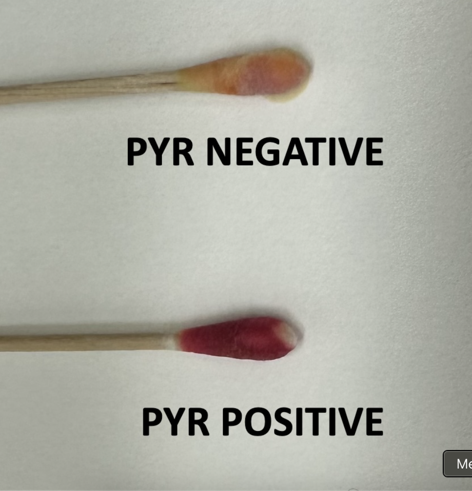 <p>PYR test</p>