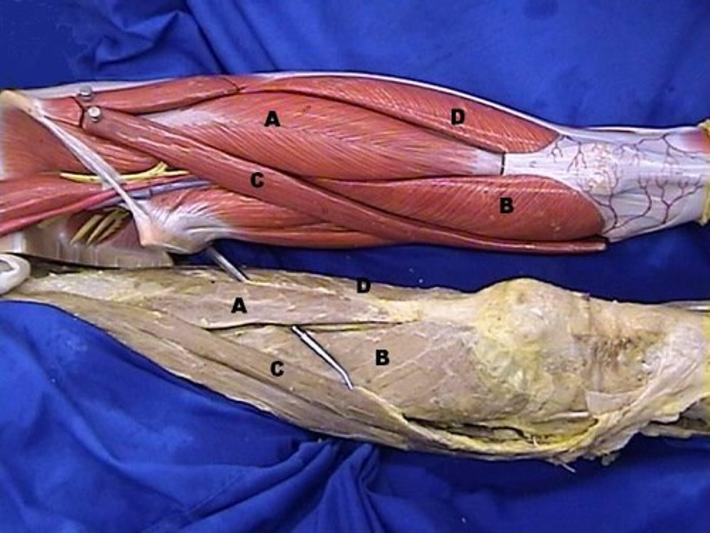 <p>A-, Extends leg at the knee and flexes thigh at the hip; part of the quadriceps group, Description: Superficial, runs straight down, middle of thigh</p>