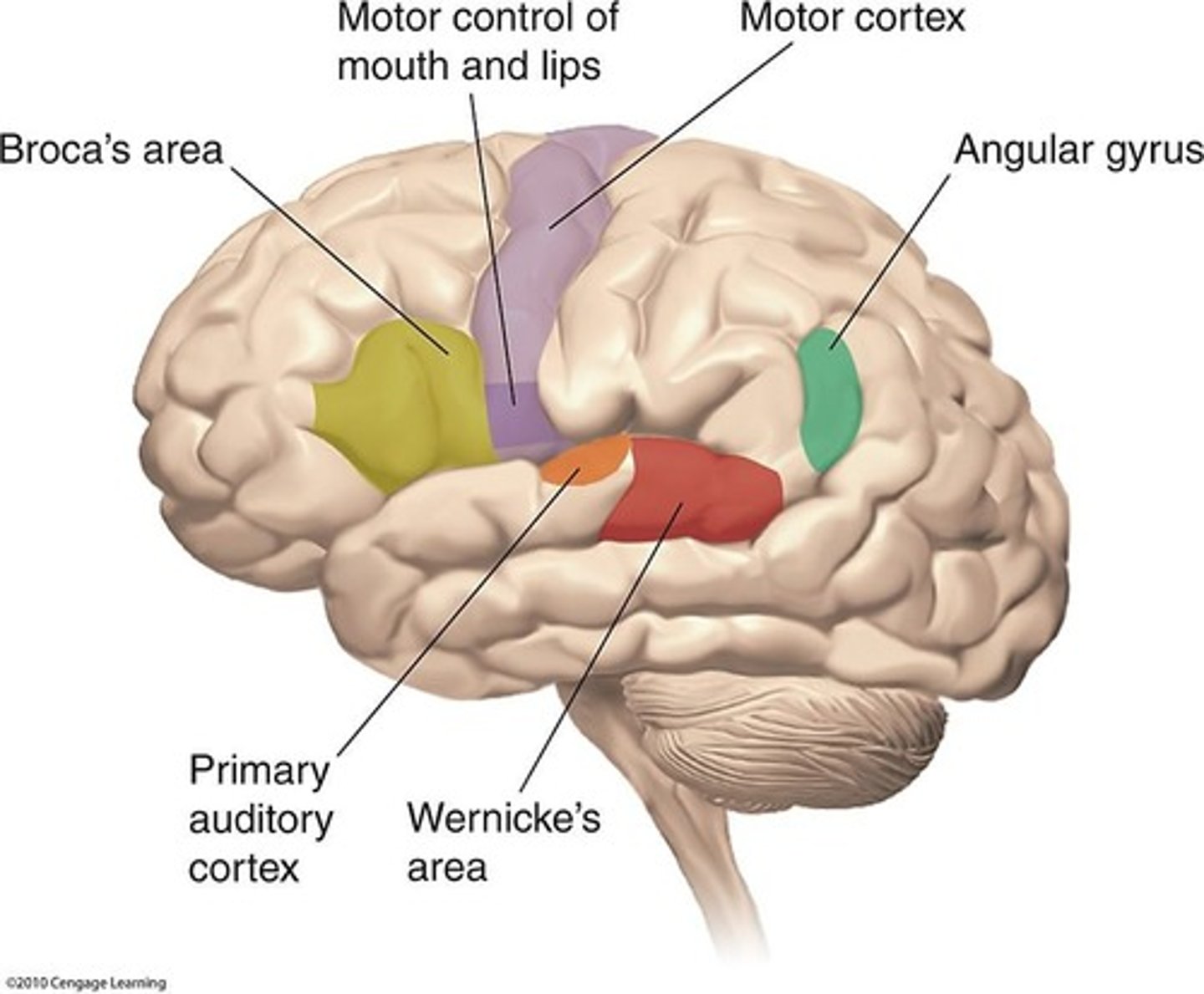 <p>Paul Broca's patient (real name Leborgne) experienced significant damage in Broca's area, indicating the importance of localization of language functions.</p>