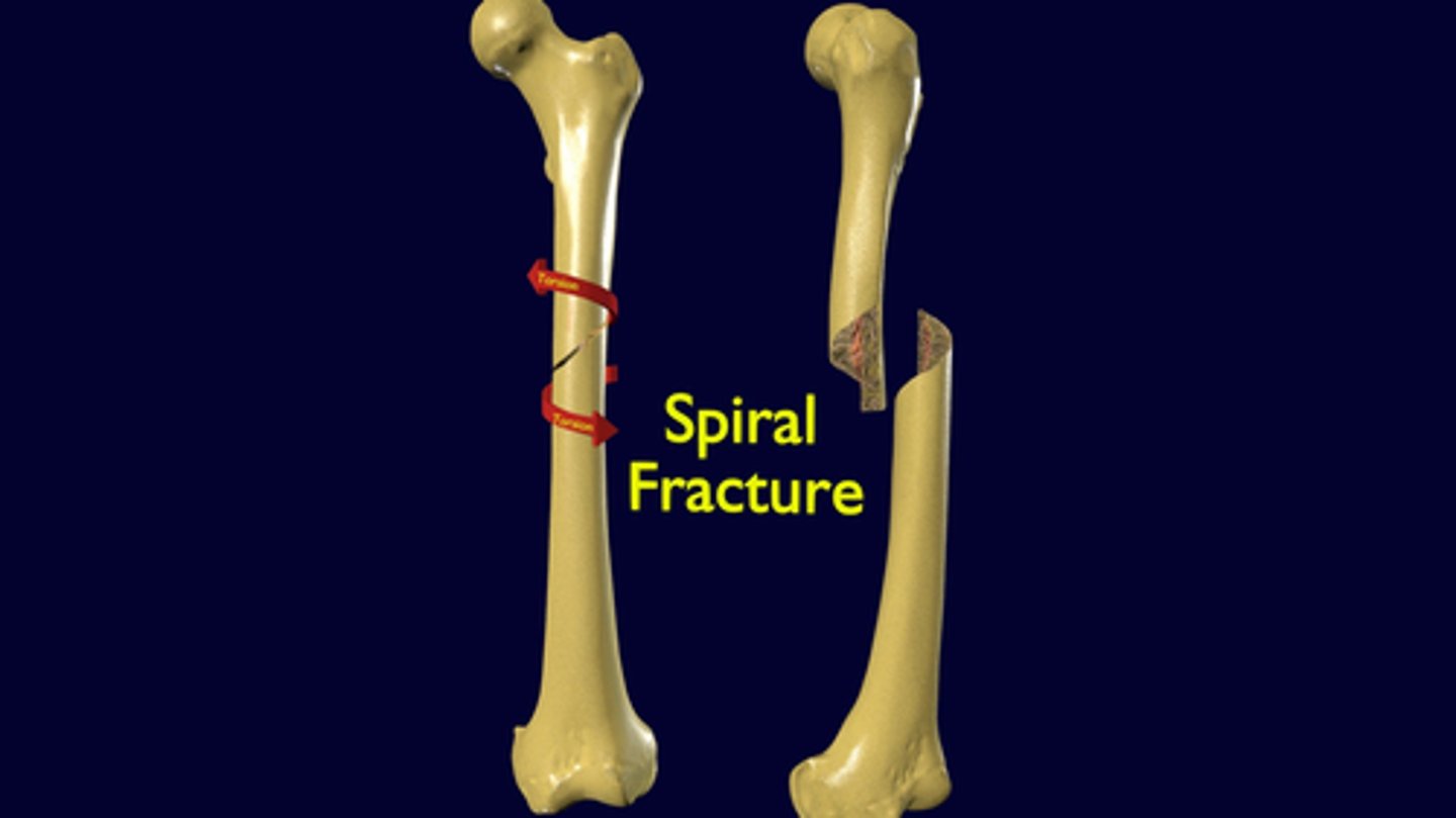 <p>Slanting and circular, twisting around the bone shaft. </p>