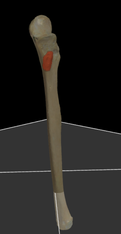 <p>Ruwheid juist onder de processus coronoideus.</p>