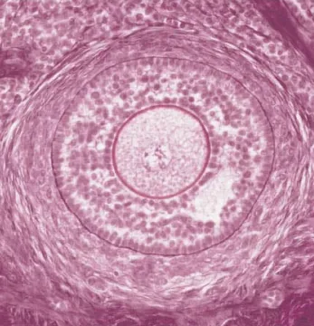 <p>Preantral | Late Secondary Follicle&nbsp;</p>