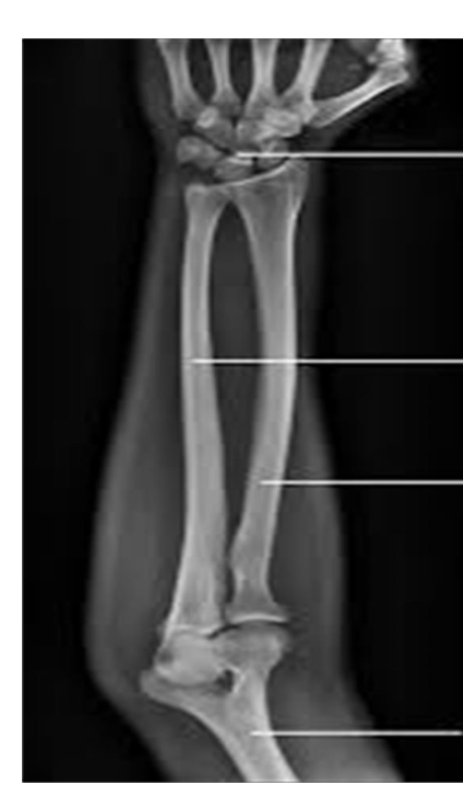 <p>Identify the structures ? name of the bone ? View?</p>