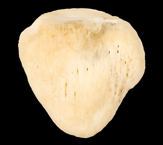<p>Name this bone.</p><p>(Anterior view, right side).</p>