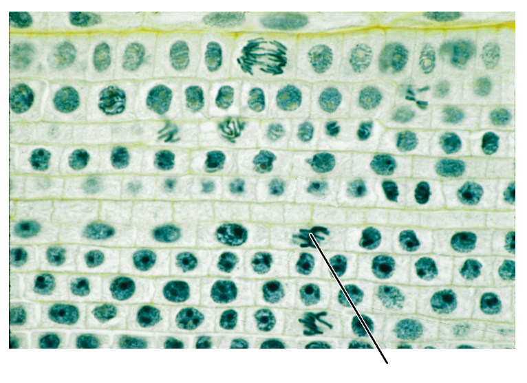 <p>What stage of mitosis is shown by this cell?</p><p>(Longitudinal section of an onion root tip).</p>