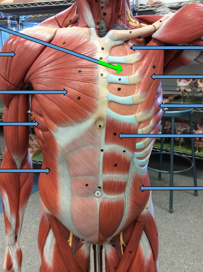 <p>Identify this muscle?</p>