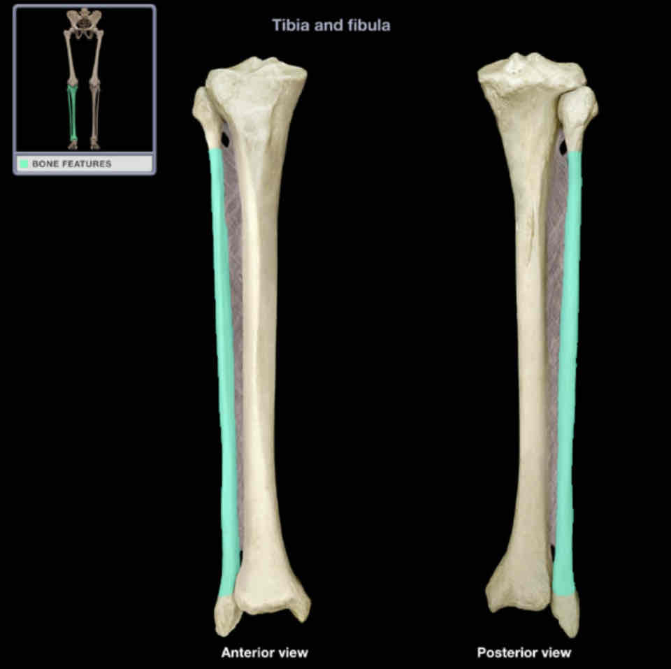 <p>Shaft of fibula </p>
