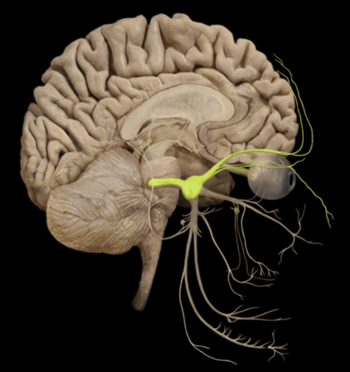 <p>ophthalmic nerve; first of three divisions of trigeminal nerve</p><p>passageway: superior orbital fissure</p><p>function: touch, temperature, and pain sensations from upper face</p>