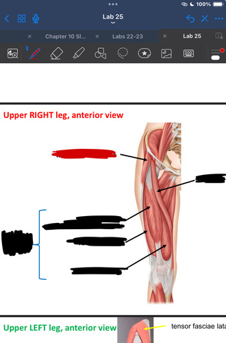 <p>What muscle is this?</p>
