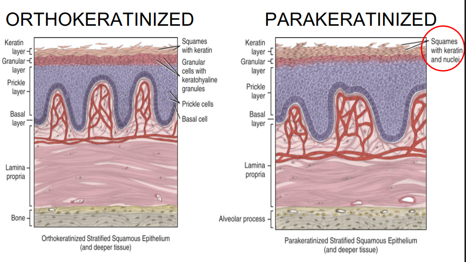 <p>Presence (<strong>parakeratinized</strong>) or absence (<strong>orthokeratinized</strong>) of nuclei in the keratinized layer.</p><ul><li><p>Parakeratinized has a thinner keratin layer than orthokeratinized</p></li></ul><p></p>