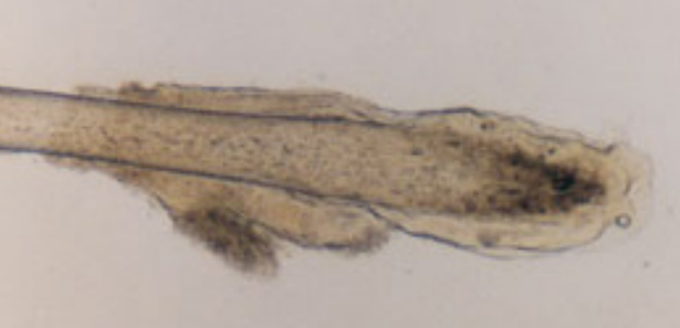 <p>follicle-attached root</p>