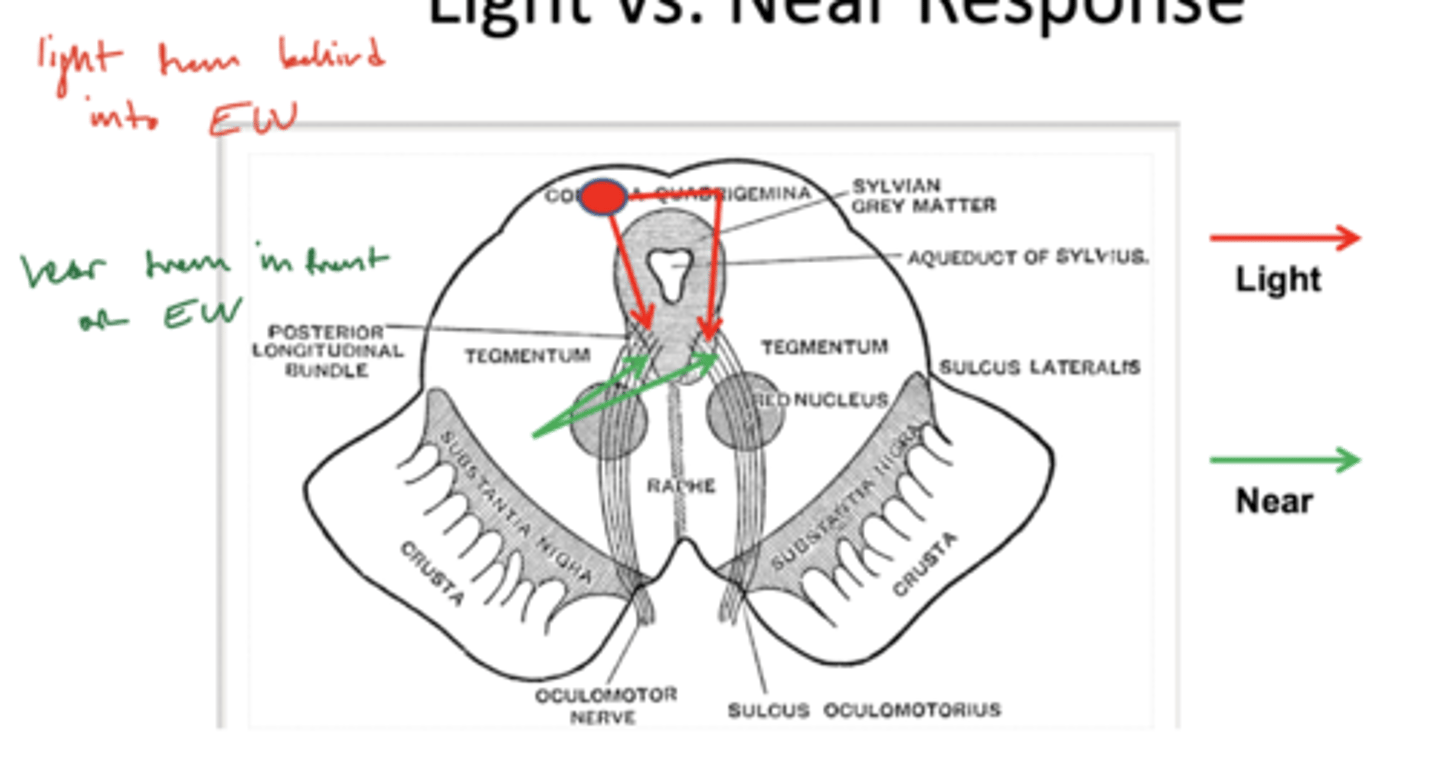 <p>light -- posterior</p><p>near -- anterior</p>
