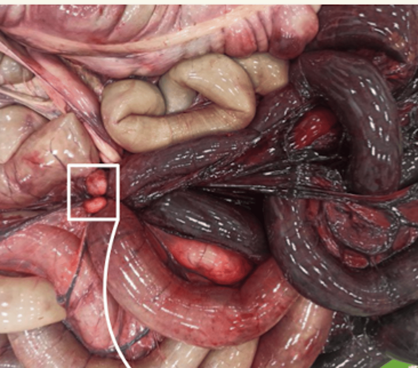 <p>¿patología?</p>