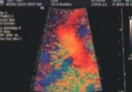 <p>Color gain is set at 100% and this was seen on US. </p><p>Is this an adequate image to have or what should be done to correct it?</p>