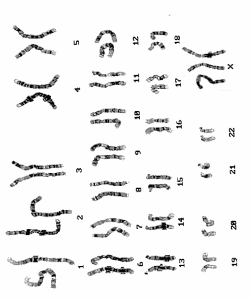 <p>Name:</p><p>- Correctly written karyotype</p><p>- Common name</p><p>- Scientific name</p><p>- One distinguishing clinical feature</p><p>- Definition of this feature if not obvious</p>