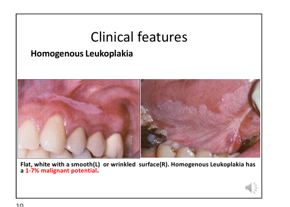 <p>Clinical Types of Leukoplakia </p>