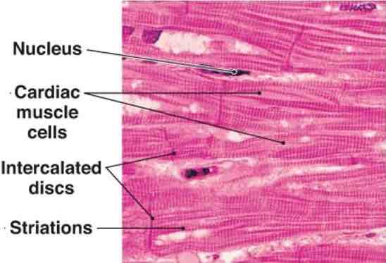 <p>Alternating light and dark bands found in skeletal and cardiac muscle fibers, indicating the presence of organized myofibrils.</p>