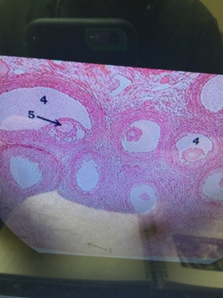 <p>Number four pictured above...central cavity that appears in a secondary follicle that is filled with fluid..?</p>
