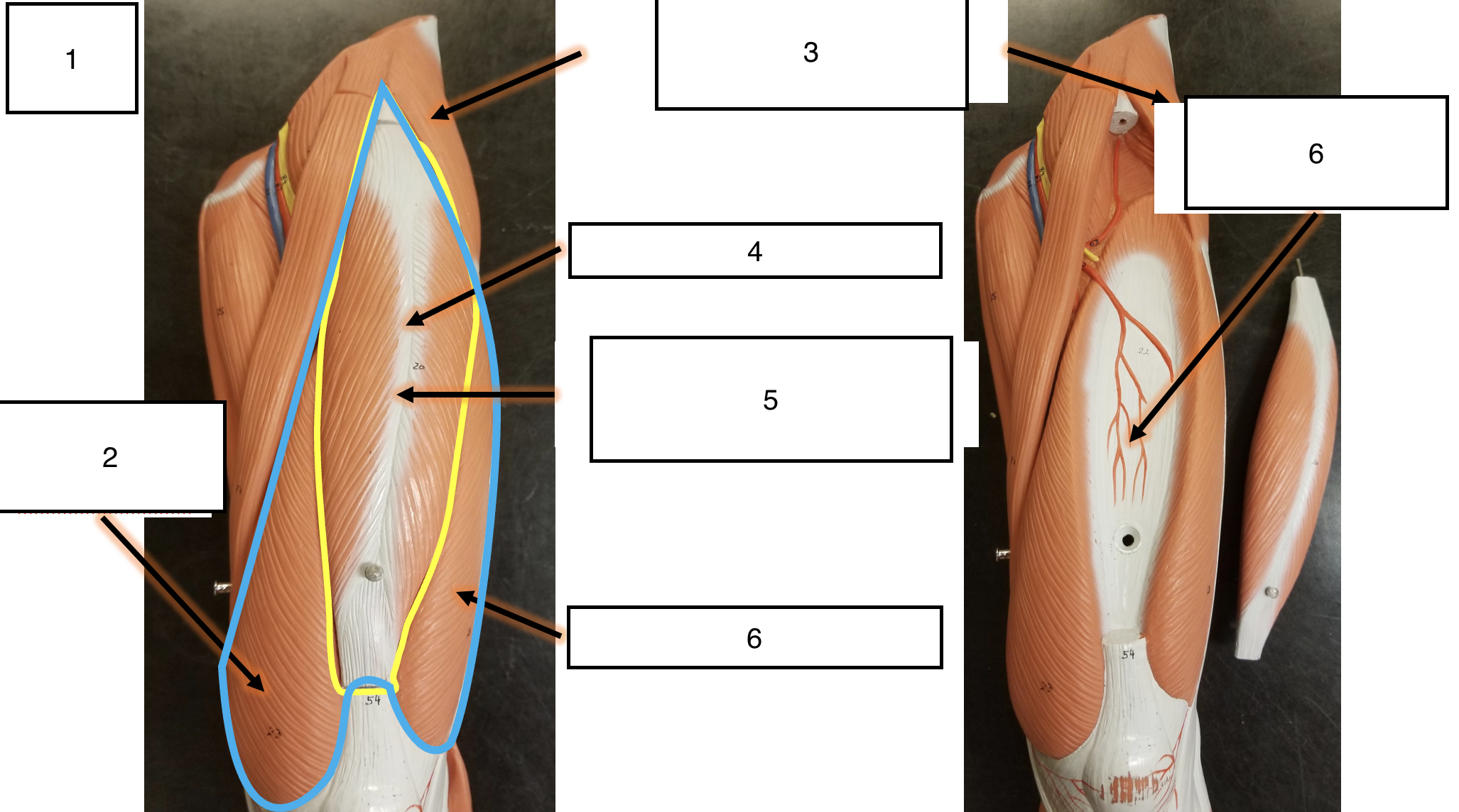 <p>name the muscle (6)</p>